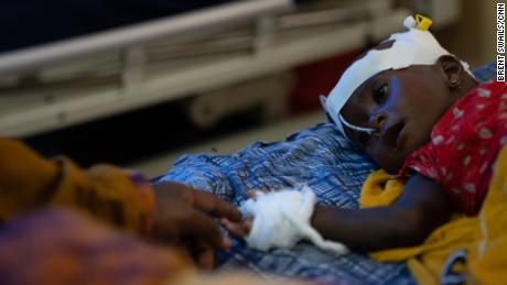 Fatima Abdullah berührt ihre 8 Monate alte Tochter Abdi, die im Juli in Somalia mit schwerer Unterernährung ins Krankenhaus eingeliefert wurde.